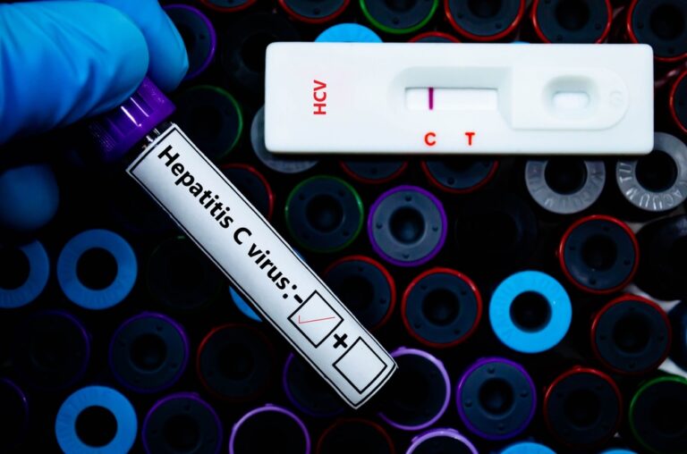 ADH_Hepatitis-C